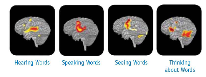 thinking-brain_75837_3